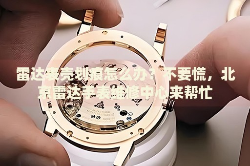 雷達表殼劃痕怎么辦？不要慌，北京雷達手表維修中心來幫忙
