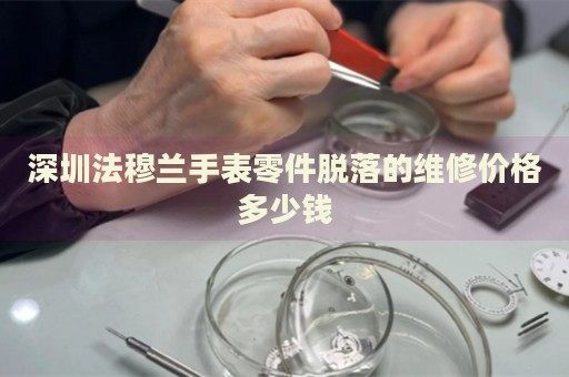 深圳法穆蘭手表零件脫落的維修價格多少錢